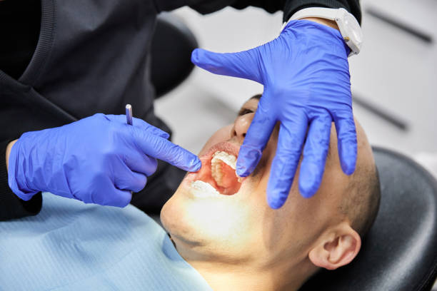 Best Pediatric Emergency Dentist in Laporte, CO